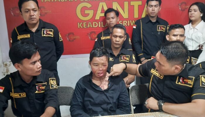 Pelaku Tak Kunjung Ditangkap, Korban Penyiraman Air Keras Suaminya Minta Keadilan Kepada Presiden dan Kapolri