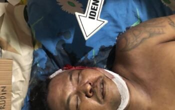 Hari Pertama Beroperasi, Keributan Pecah di Diskotik Club 41 Darma Agung Palembang Satu Nyawa Melayang