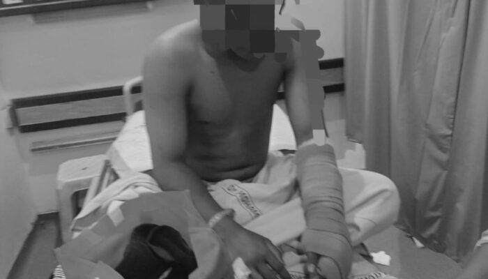 Disuruh Ibu Nagih Utang, Remaja di Palembang Dikeroyok dan Kena Bacok